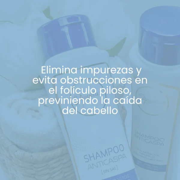 Anyeluz shampoo anticaspa